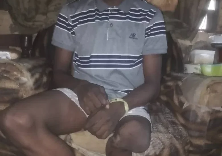 Help me walk again, 17-year-old boy seeks N2m for amputation, artificial limb